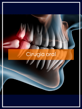 Tratamientos dentales Cirugia Oral Madrid
