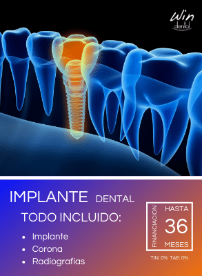 Dentista Madrid Oferta precio implante dental total
