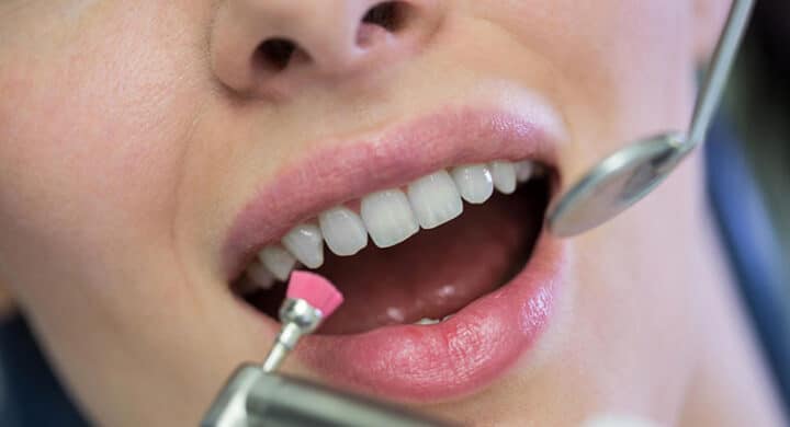 Sensibilidad dental limpieza de boca