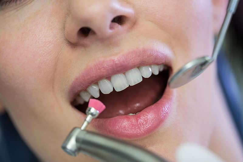 Sensibilidad dental limpieza de boca